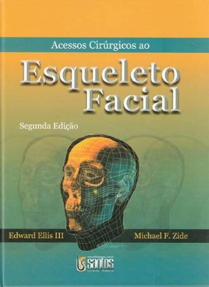 Acessos Cirúrgicos ao Esqueleto Facial