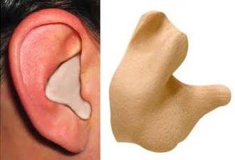 Protetor Auricular Ahead Molded Earplugs Molde Personalizado ACME se molda exclusivamente à orelha