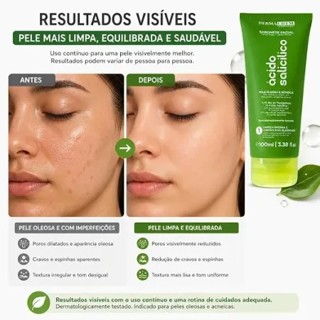 Sabonete Ácido Salicílico Pele Oleosa e Acneica- Dermachem Laboratory 100ml