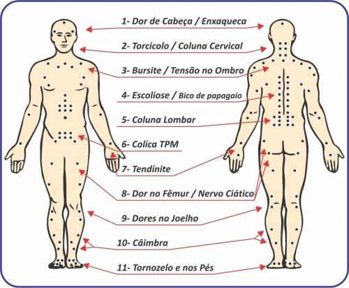 Cinta Redutora Abdominal : Estética : Senday  Cintas Redutoras,  Colchonetes Magnéticos Dobráveis, Cinta Magnética e Emplastos Magnéticos